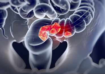 Stard7, un acteur clé et ambigu dans le développement du cancer du côlon