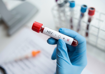 L'ASBL Exaequo organise une semaine de dépistage sur le VIH, la syphilis et l'hépatite C