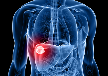 Les cancers du foie devraient augmenter de 55% d'ici 2040, prédit une étude