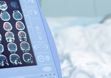 Prescription d’imagerie : une aide à la décision attendue fin septembre 2026