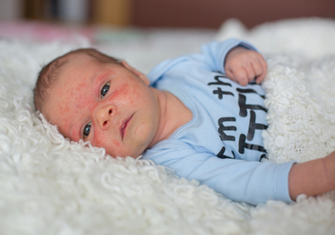 Vijf vuistregels moeten aantal accidentele overlijdens bij baby's doen dalen