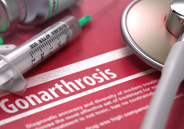 Tofacitinib versus placebo bij beginnende knieartrose