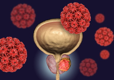 Le terbium-161 PSMA-I&T, une molécule prometteuse dans le cancer de la prostate résistant à la castration