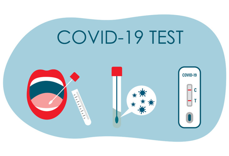 COVID19 : les tests antigéniques désormais autorisés pour les cas contact