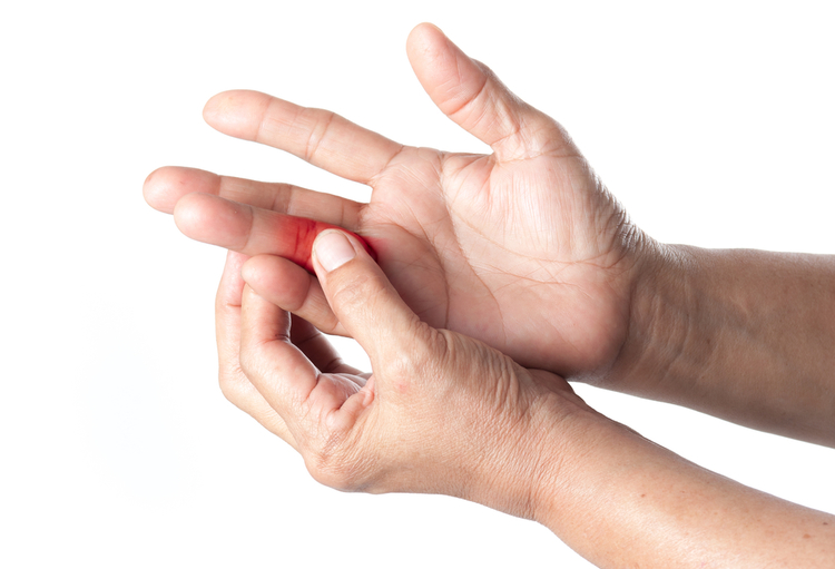 Douleur chronique au doigt: pensez à un ostéome ostéoïde - Ortho-Rhumato