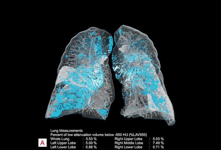 Siemens Healthineers geeft radiologen intelligente digitale assistent ...