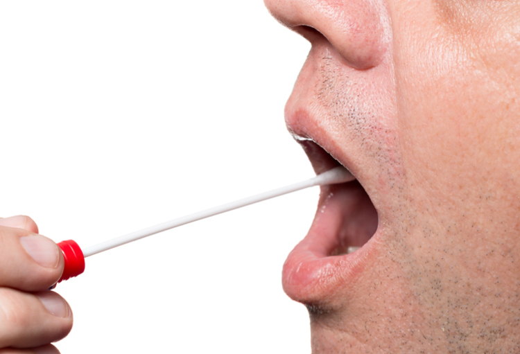 Test salivaire 6 drogues normé CE