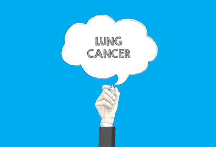 COPD gerelateerd aan een hoger risico op longkanker, zelfs bij nietrokers De Specialist