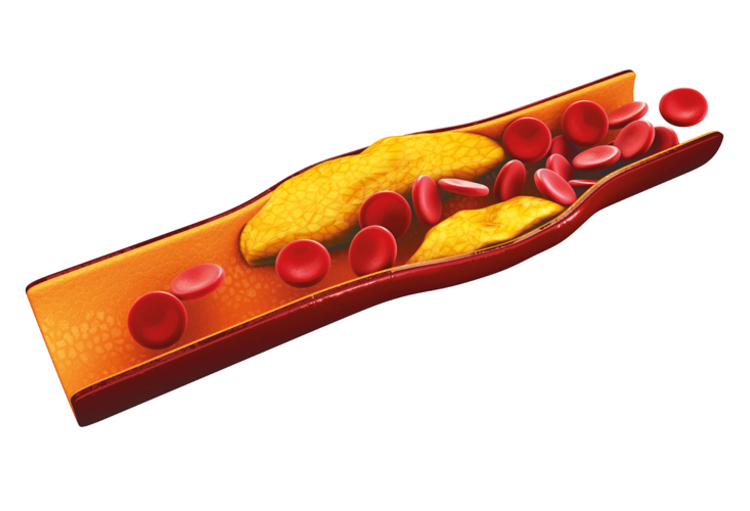 La Ligue Cardiologique Belge Lance Une Campagne Pour Mieux Comprendre