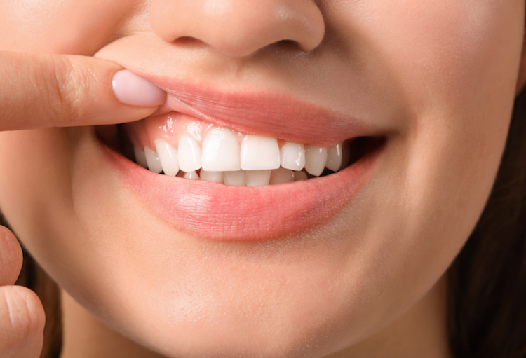 Des Dépistages Gratuits Jeudi Lors De La Journée Internationale De La Santé Gingivale Le 