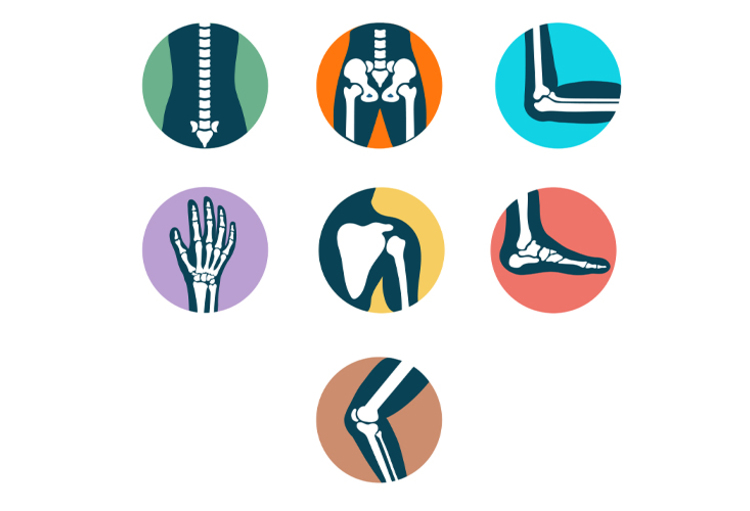 Orthopedie van de grote gewrichten – het schurend scharniertje