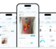 TwinSkin, l'innovation belge qui modélise les plaies en 3D