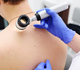 Euromelanoma en Stichting tegen Kanker lanceren campagne voor 