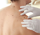 Dermatologennetwerk roept hulp in van beroepen die veel huid zien