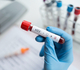 Doorbraak in hiv-onderzoek: methode ontwikkeld die virus definitief onschadelijk maakt 