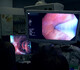 Un nouvel outil endoscopique unique en Wallonie pour la détection précoce des nodules pulmonaires